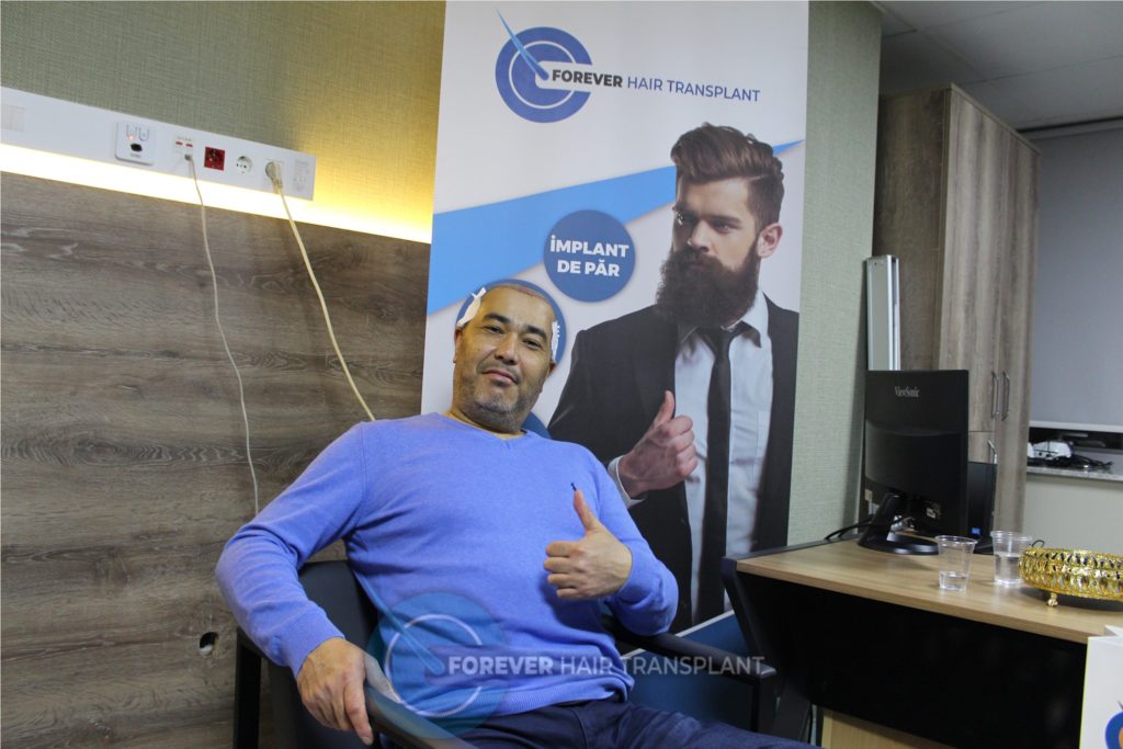Forever Hair Transplant
