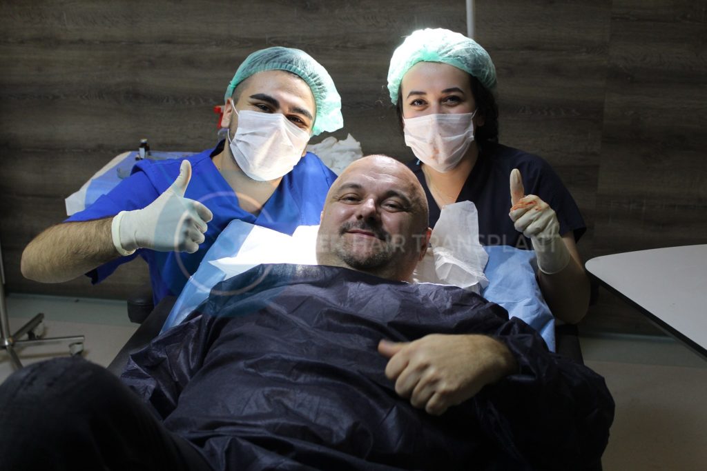 Forever Hair Transplant