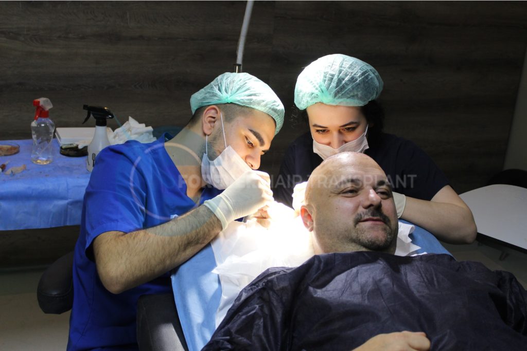 Forever Hair Transplant