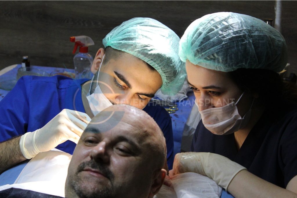 Forever Hair Transplant