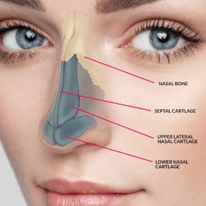 rhinoplasty